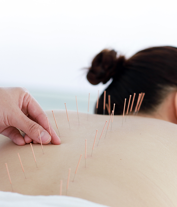 Acupuncture East Keansburg, NJ